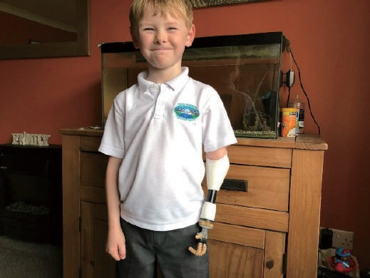 数字技术与医学的碰撞，开创全新“处方”|三维扫描助力数字化医疗